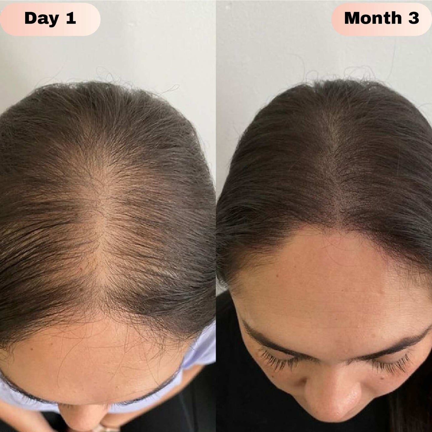 Revivra™ Advanced Hair Growth Roll-On Serum