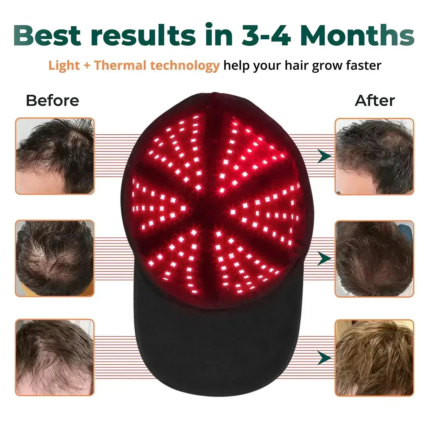 Revivra™ Red Light Therapy Hair Regrowth Cap | For No/Short Hair