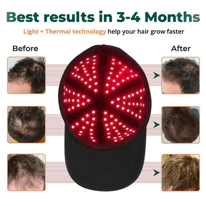 Revivra™ Red Light Therapy Hair Regrowth Cap | For No/Short Hair