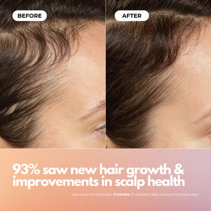 Revivra™ Red Light Therapy Root Repair Brush | For Long Hair