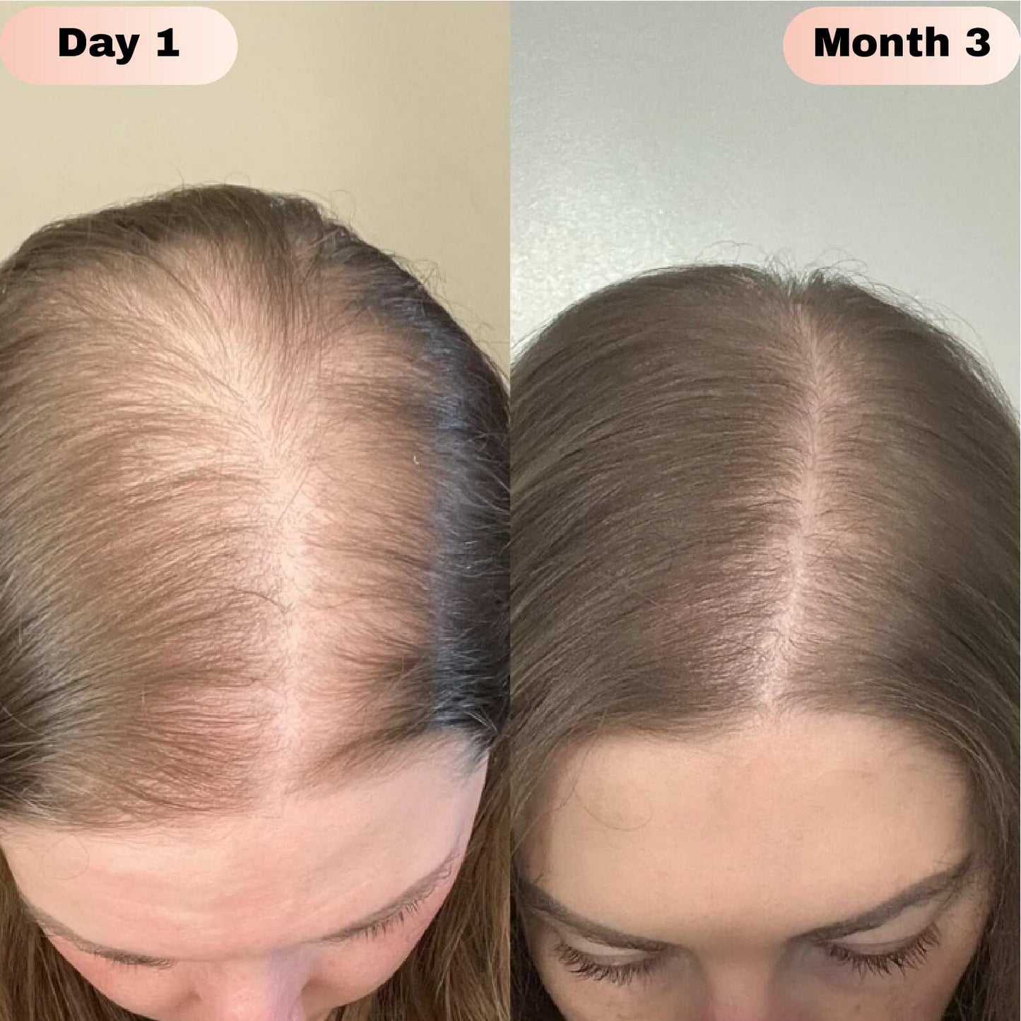 Revivra™ Advanced Hair Growth Roll-On Serum