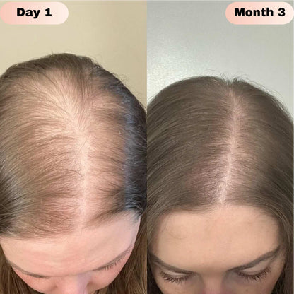 Revivra™ Advanced Hair Growth Roll-On Serum