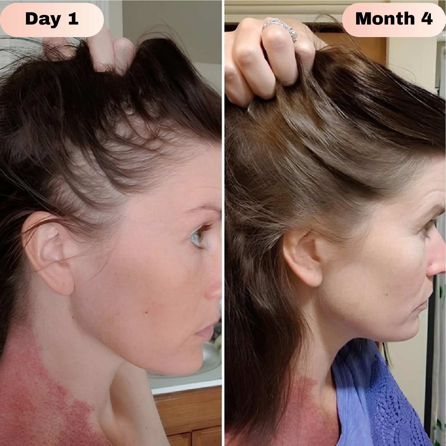 Revivra™ Advanced Hair Growth Roll-On Serum